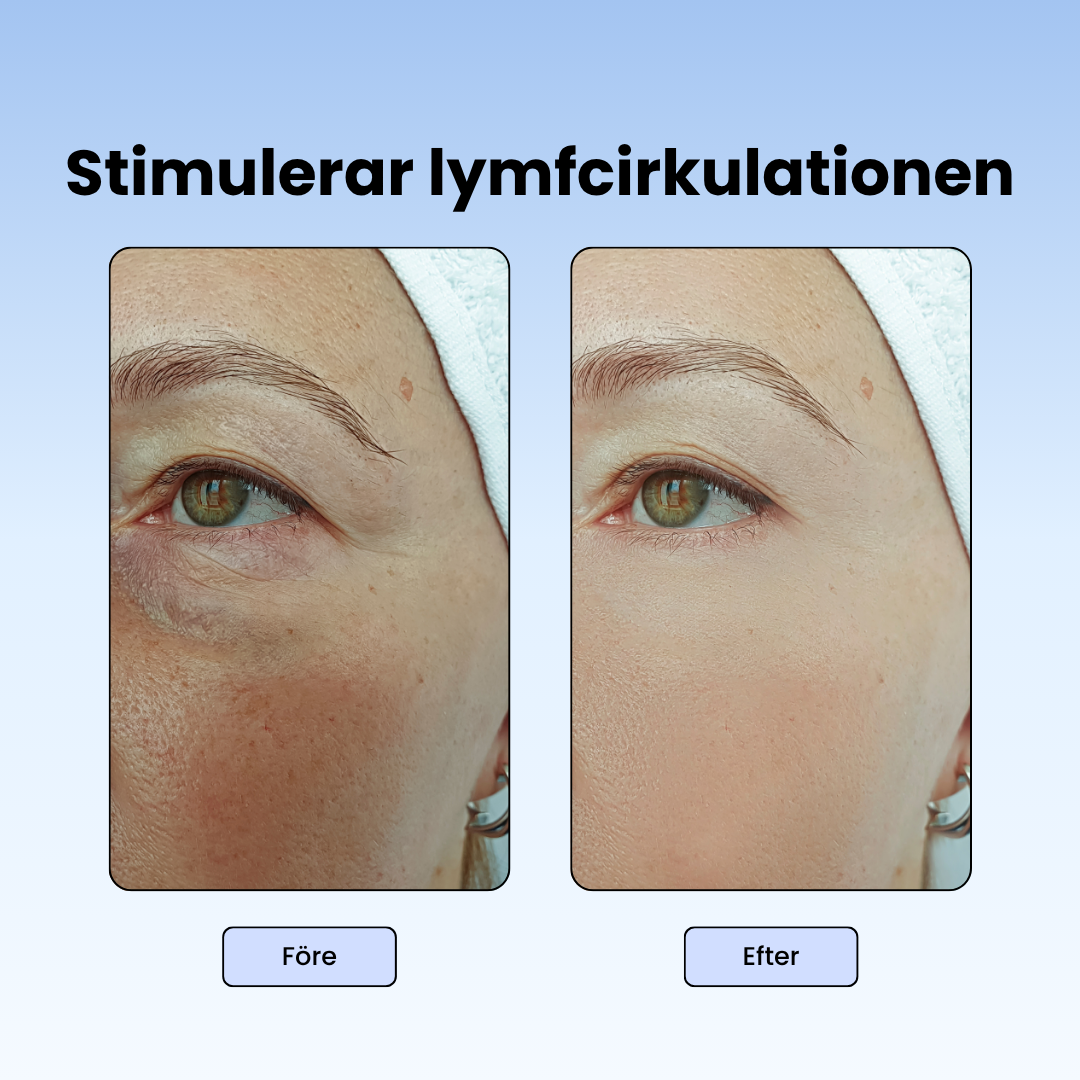 IsDopp Skål