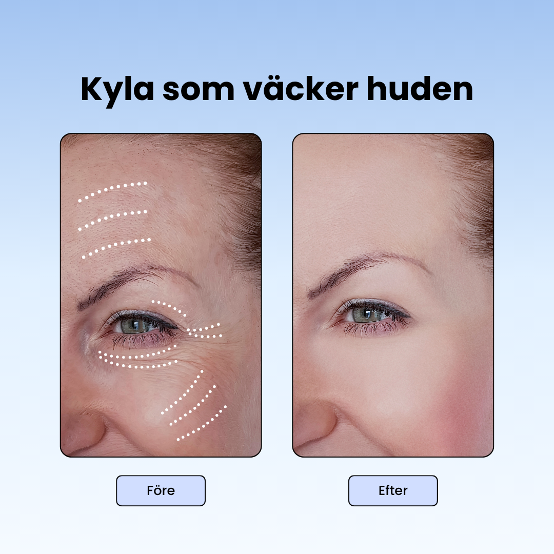 IsDopp Skål